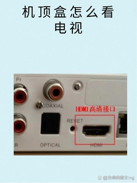 智能电视机需要机顶盒吗