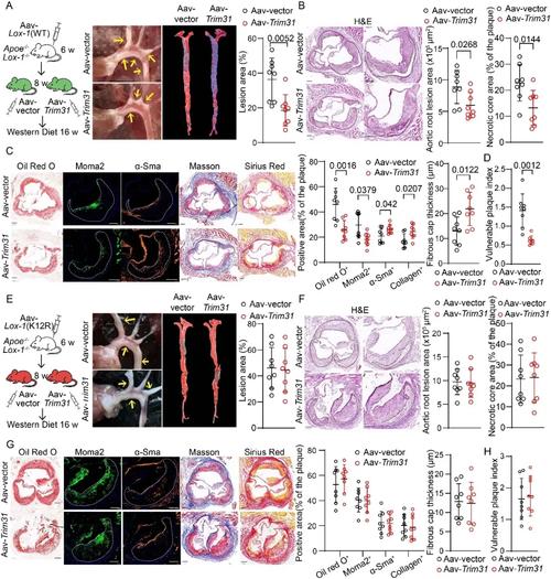 cardboard 畸变参数